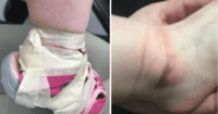 darycare tapes shoes to child