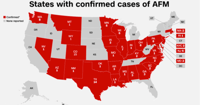polio like disease spreading