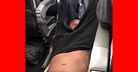 United Flight Beat Up