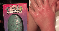 hatchimals chemical burn