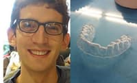 3D printer, braces,