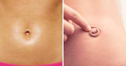 Belly button
