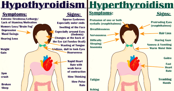 thyroid disorders