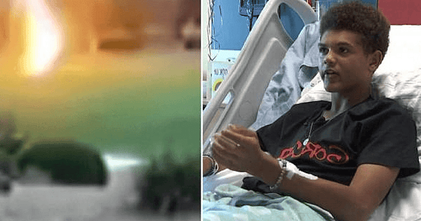 lightning teen survives