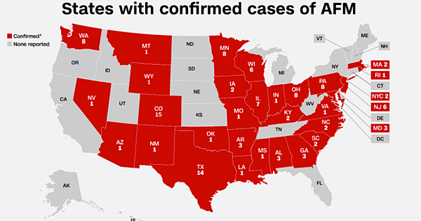 polio like disease spreading