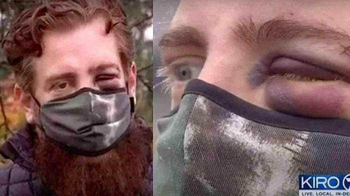 disabled Marine veteran assault masks