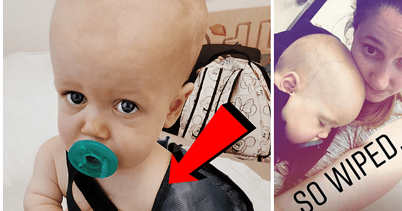 jackson roloff broken arm