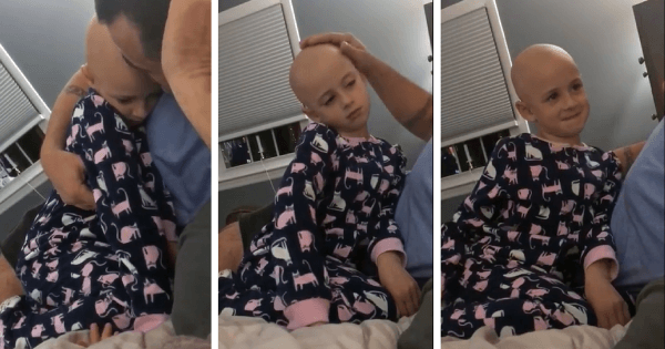 dad shaves alopecia