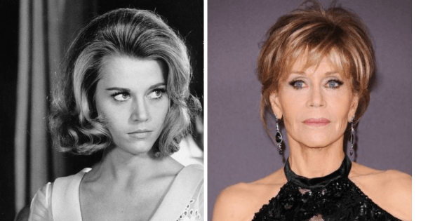 jane fonda plastic surgery