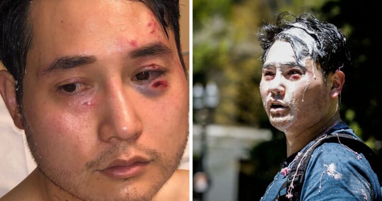 Andy Ngo Antifa lawsuit