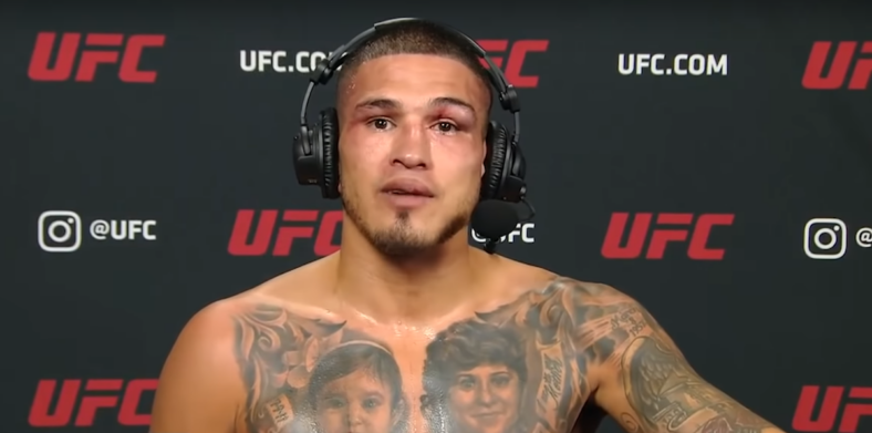 Anthony Pettis